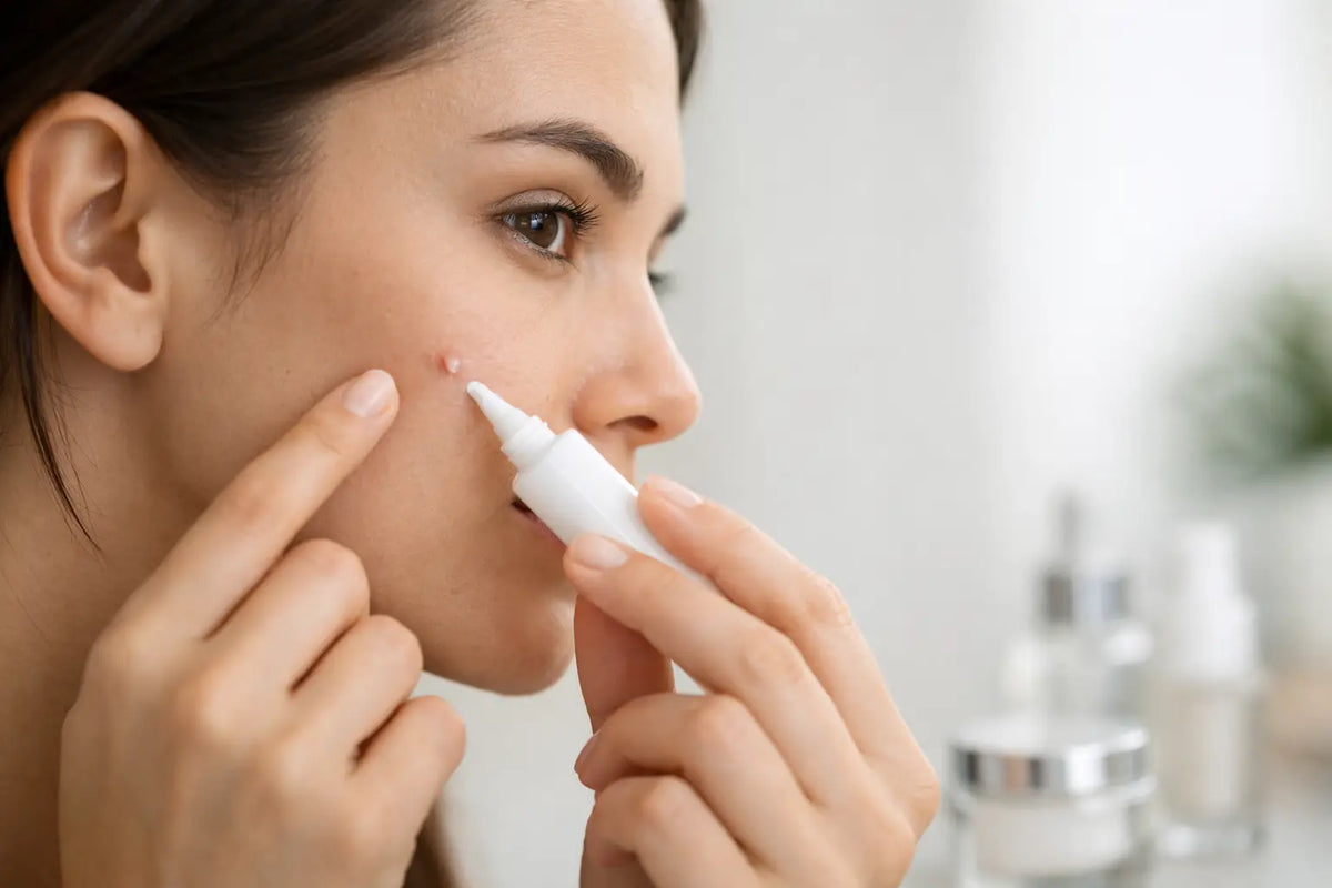 How to Use Acne Spot Treatment Properly – ALORY